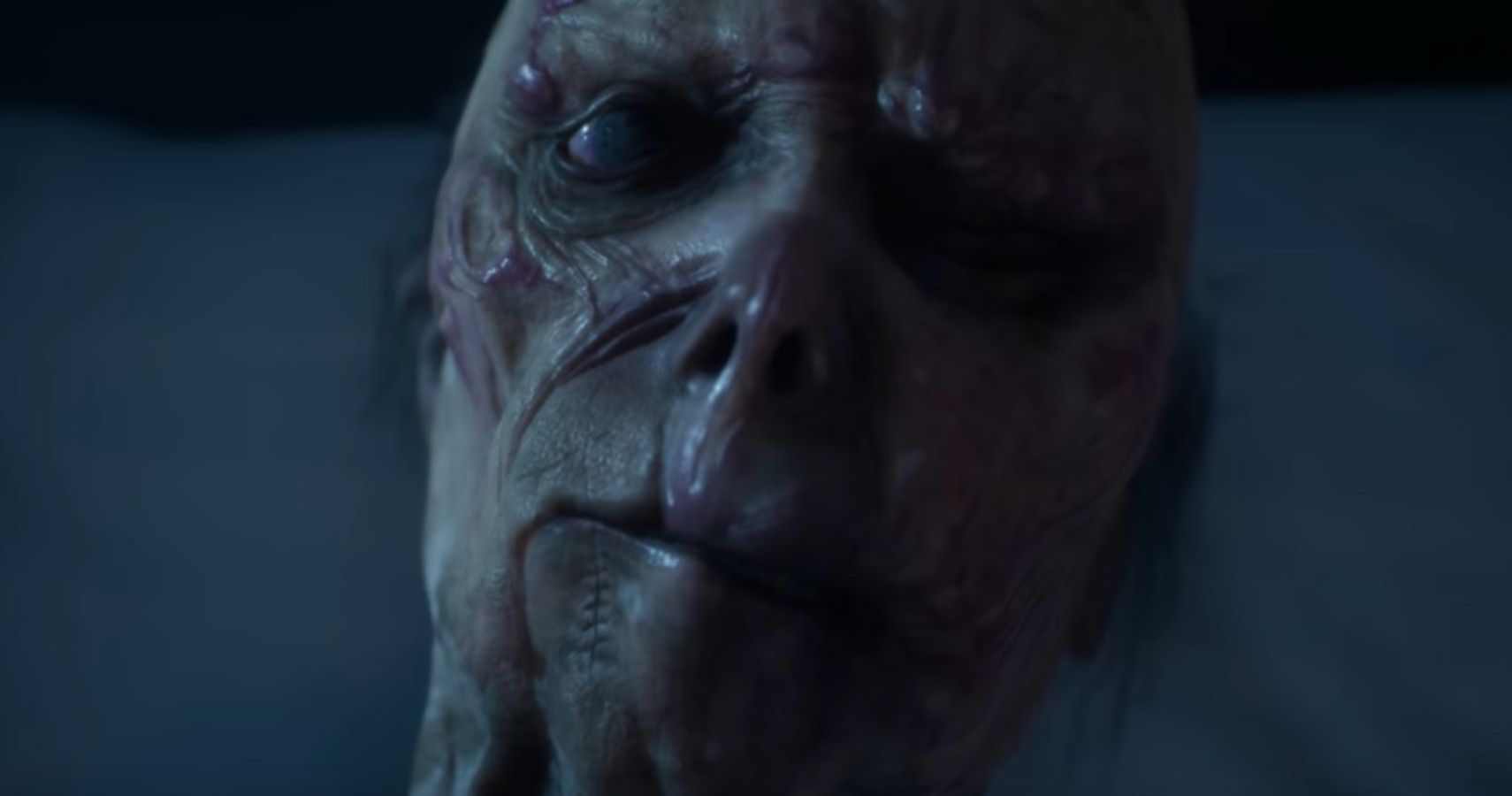 remothered
