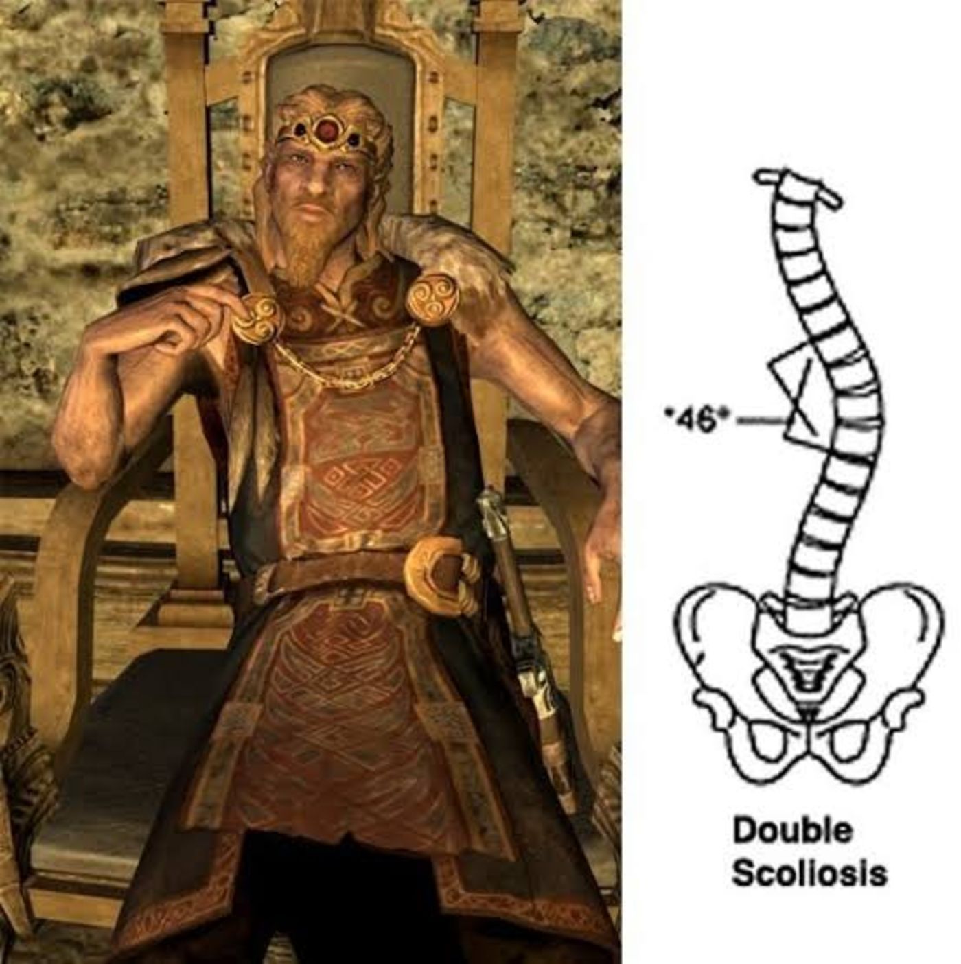 skyrim jarl's spine meme