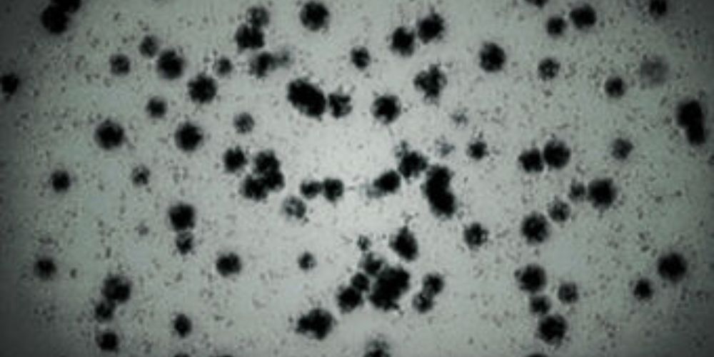 The T-Virus from resident Evil