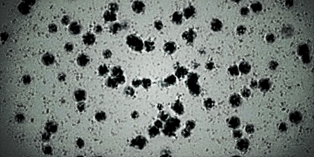 The T-Virus as seen under a microscope.