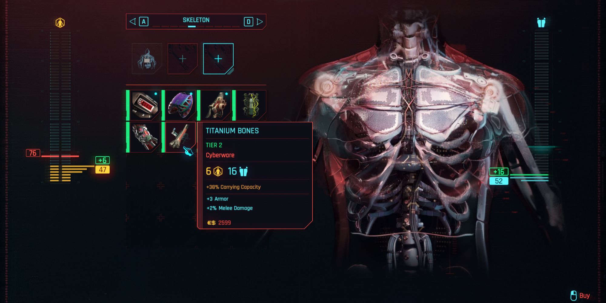 Titanium Bones in Cyberpunk 2077