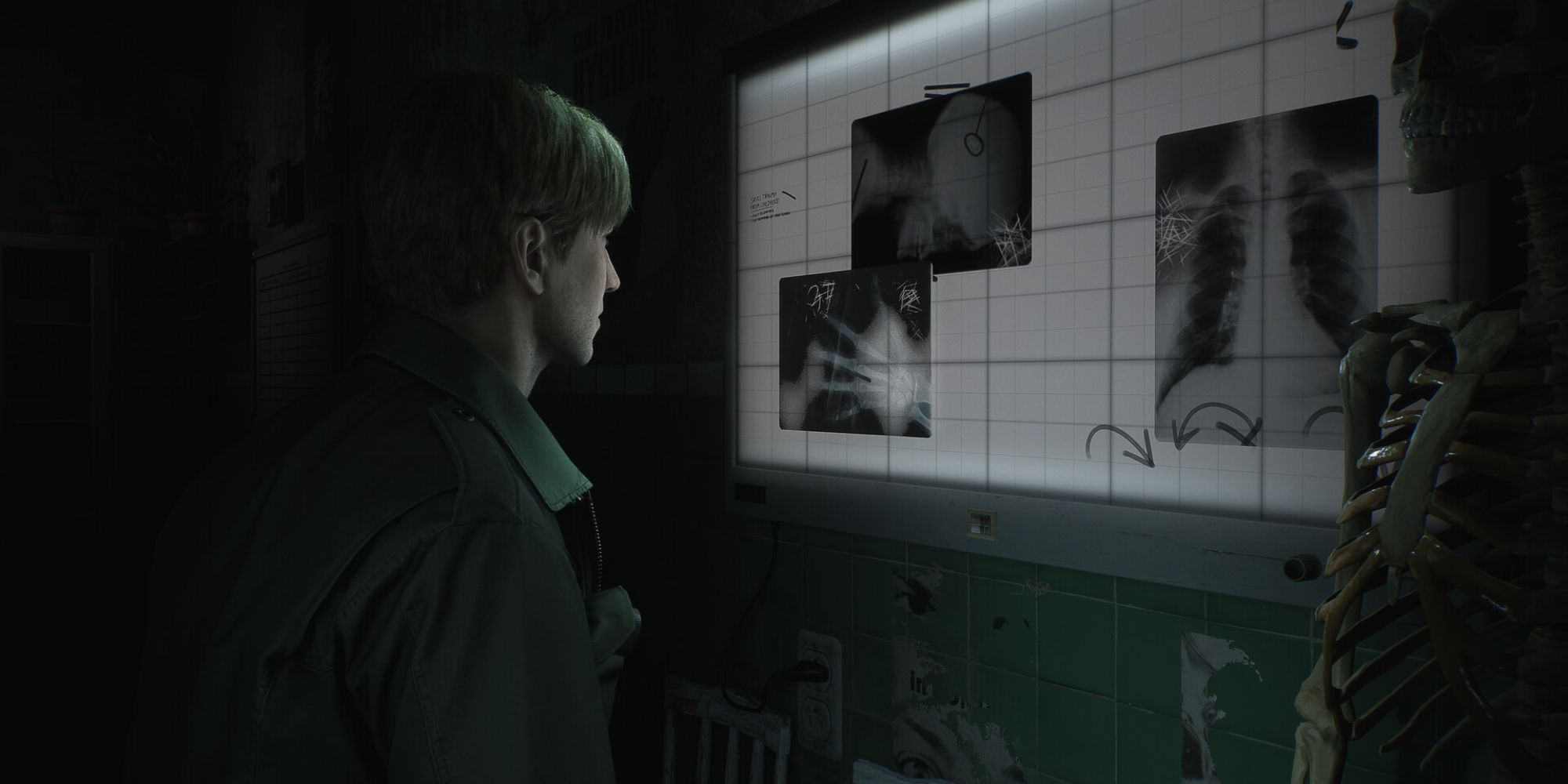 James looks at X-rays in a dark room