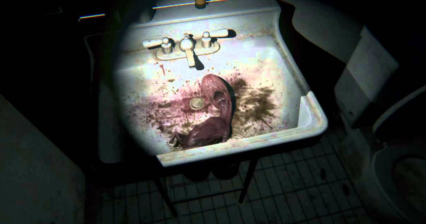 PT Fetus Sink