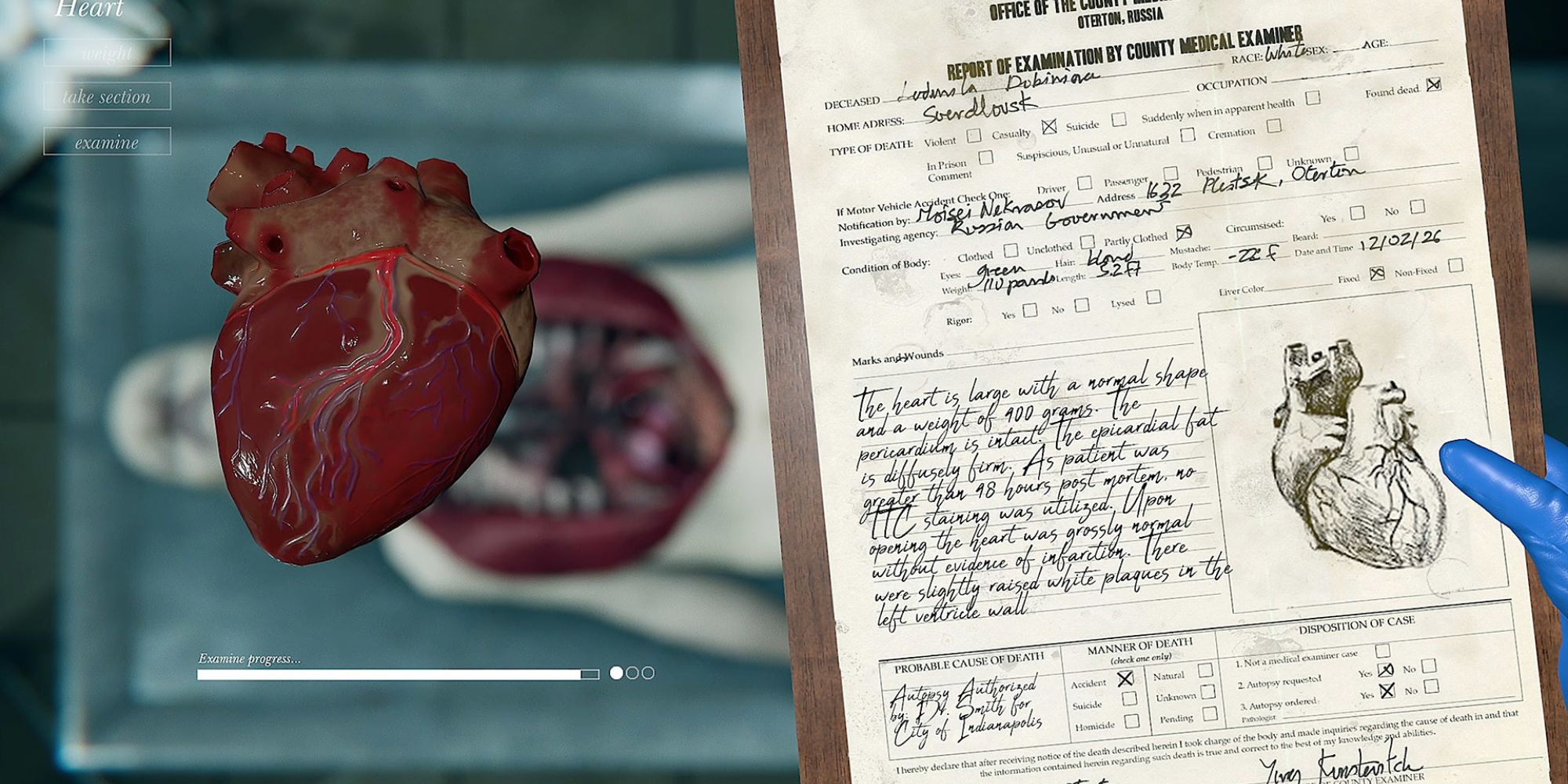 autopsy sim heart transplant report