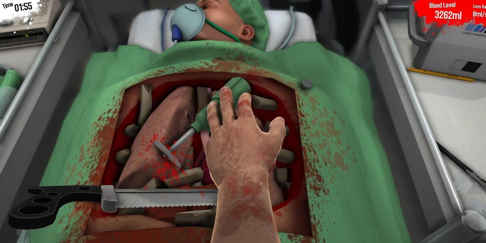 A screenshot of the player operating in Surgeon Simulator