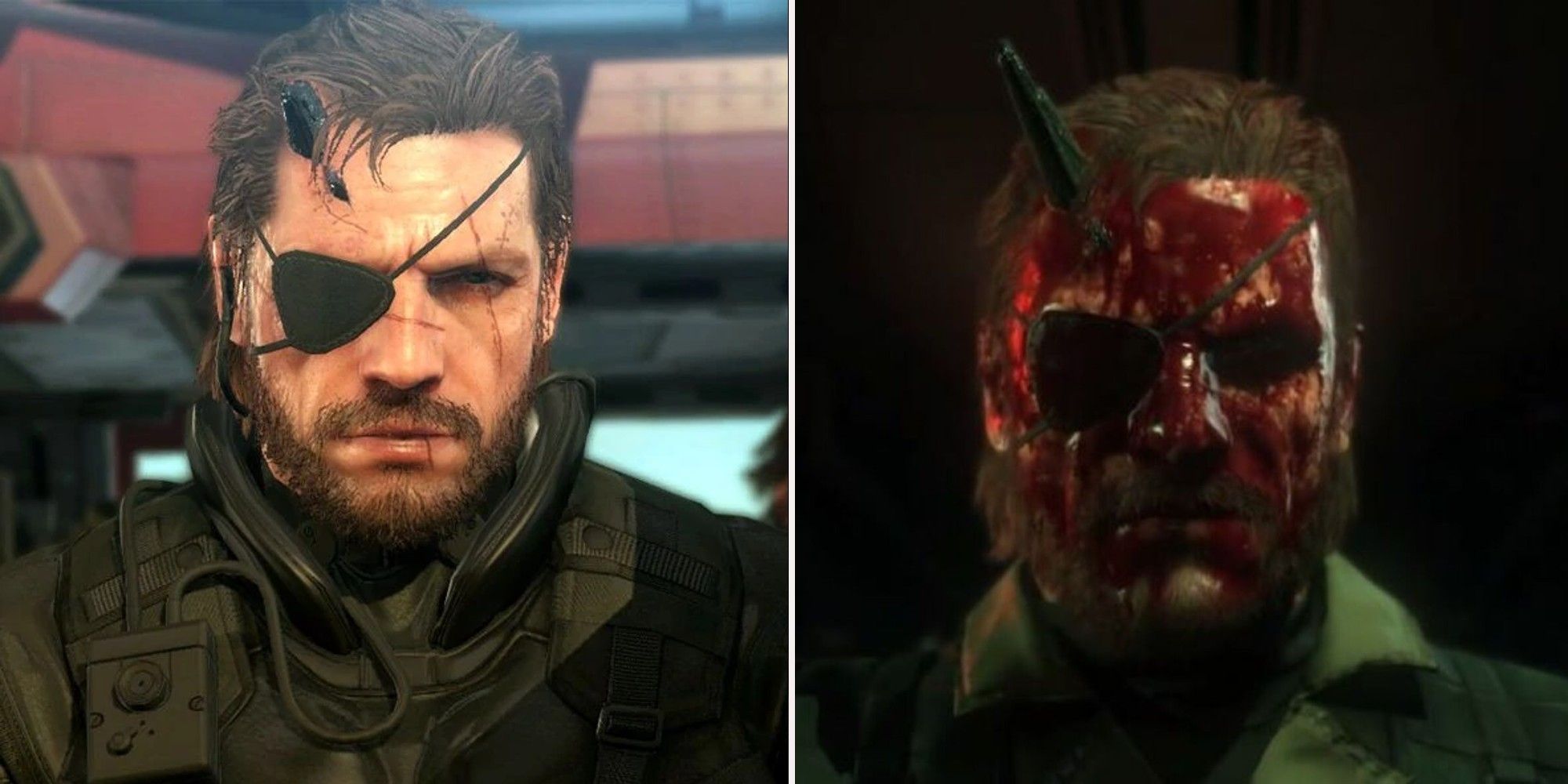 Metal Gear Solid 5 - Venom Snake and Damaged Venom Snake