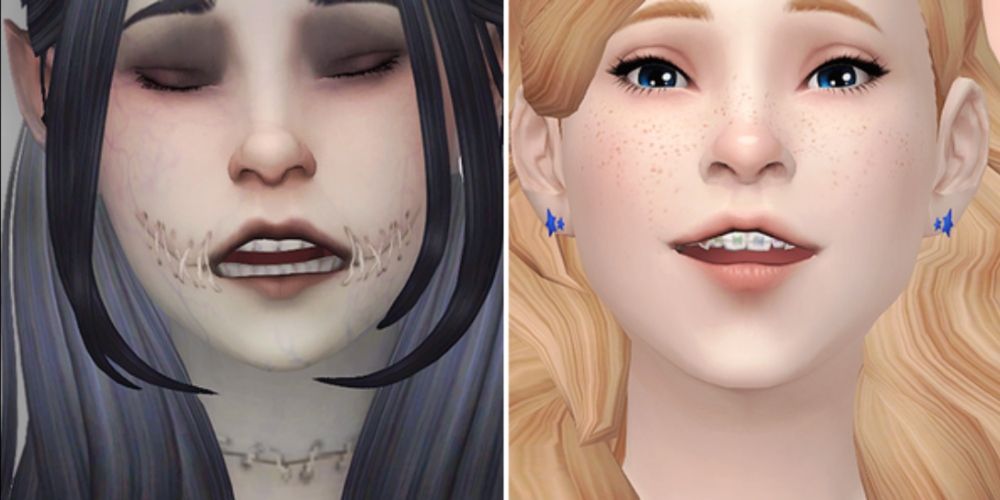 Two separate images of two different Sims, left one having straight teeth and right one having braces