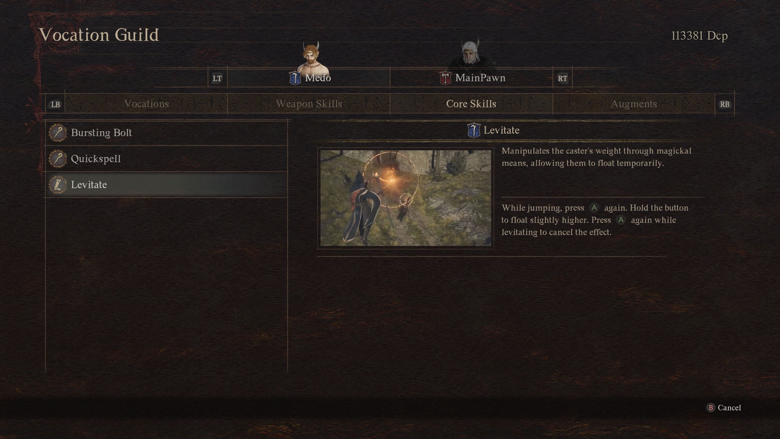 Everything You Need To Know About The Sorcerer Vocation In Dragon's Dogma 2