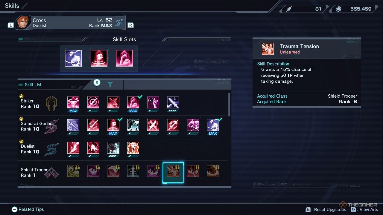 Truma Tension Xenoblade Chronicles x