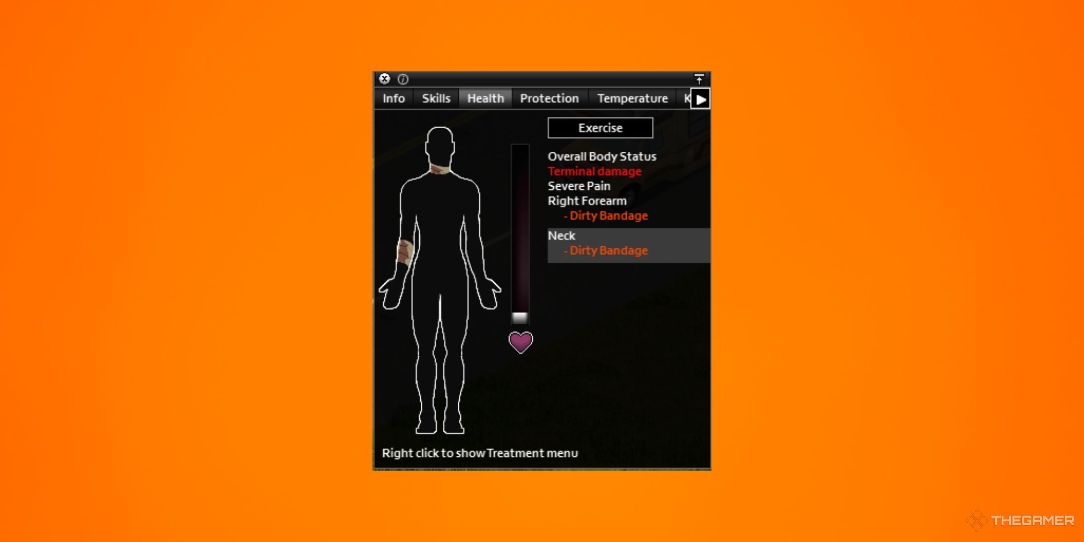 A hurt menu from Project Zomboid in front of an orange gradient backdrop.